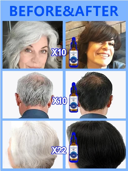 White hair killer, remove gray hair and restore natural hair color in 7 days