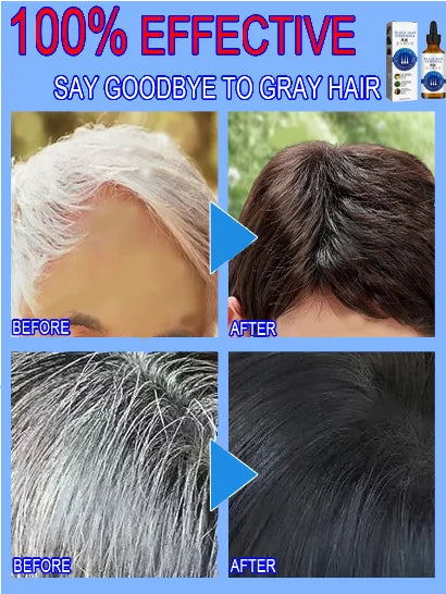 White hair killer, remove gray hair and restore natural hair color in 7 days